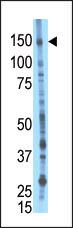 BIKE Antibody in Western Blot (WB)