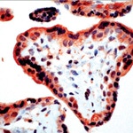 Bim Antibody in Immunohistochemistry (IHC)