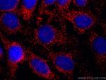 PEX14 Antibody in Immunocytochemistry (ICC/IF)