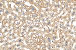 PEX14 Antibody in Immunohistochemistry (Paraffin) (IHC (P))