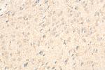 EPHX2 Antibody in Immunohistochemistry (Paraffin) (IHC (P))