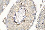IL-13RA2 Antibody in Immunohistochemistry (Paraffin) (IHC (P))