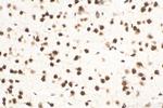 TDP-43 Antibody in Immunohistochemistry (Paraffin) (IHC (P))
