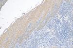KRT80 Antibody in Immunohistochemistry (Paraffin) (IHC (P))