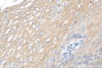 KRT80 Antibody in Immunohistochemistry (Paraffin) (IHC (P))
