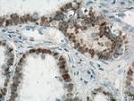 PAX8 Antibody in Immunohistochemistry (Paraffin) (IHC (P))