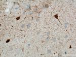 Calretinin Antibody in Immunohistochemistry (Paraffin) (IHC (P))
