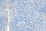 PD-L1/CD274 Antibody in Immunohistochemistry (Paraffin) (IHC (P))