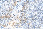 PD-L1/CD274 Antibody in Immunohistochemistry (Paraffin) (IHC (P))