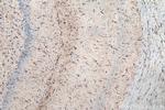 GFAP Antibody in Immunohistochemistry (Paraffin) (IHC (P))