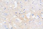 L1CAM Antibody in Immunohistochemistry (Paraffin) (IHC (P))