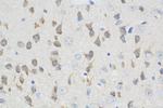 L1CAM Antibody in Immunohistochemistry (Paraffin) (IHC (P))