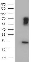 BIRC3 Antibody in Western Blot (WB)
