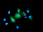 BIRC5/Survivin Antibody in Immunocytochemistry (ICC/IF)