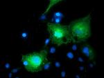 BIRC5/Survivin Antibody in Immunocytochemistry (ICC/IF)