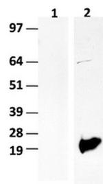BIRC5/Survivin Antibody in Western Blot (WB)
