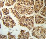 BLNK Antibody in Immunohistochemistry (IHC)