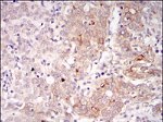 BLNK Antibody in Immunohistochemistry (Paraffin) (IHC (P))