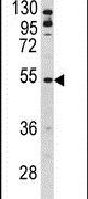 BLNK Antibody in Western Blot (WB)