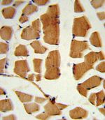 BMI-1 Antibody in Immunohistochemistry (IHC)