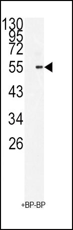 BMI-1 Antibody in Western Blot (WB)