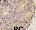 BMP-15 Antibody in Immunohistochemistry (IHC)