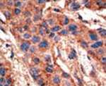 BMPR1A Antibody in Immunohistochemistry (IHC)