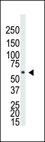 BMPR1A Antibody in Western Blot (WB)