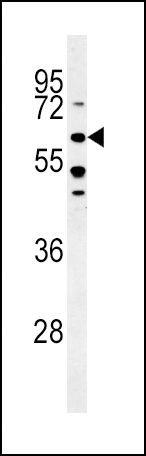 BMPR1A Antibody in Western Blot (WB)