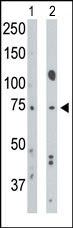 BMPR1A Antibody in Western Blot (WB)