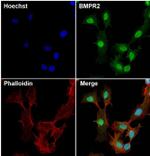 BMPR2 Monoclonal Antibody (3F6F8)