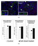 Ki-67 Antibody in Immunohistochemistry (IHC)
