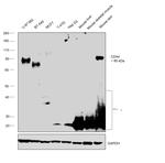 CD44std Antibody in Western Blot (WB)