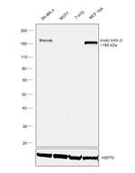 ErbB2 (HER-2) Antibody in Western Blot (WB)