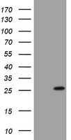 BNIP1 Antibody in Western Blot (WB)