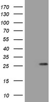 BNIP1 Antibody in Western Blot (WB)
