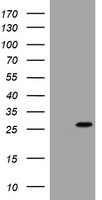 BNIP1 Antibody in Western Blot (WB)