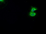 BRAF Antibody in Immunocytochemistry (ICC/IF)