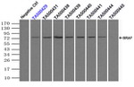 BRAF Antibody in Immunoprecipitation (IP)