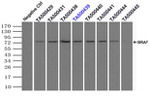 BRAF Antibody in Immunoprecipitation (IP)