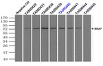 BRAF Antibody in Immunoprecipitation (IP)