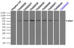 BRAF Antibody in Immunoprecipitation (IP)