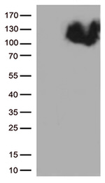 BRAF Antibody in Western Blot (WB)