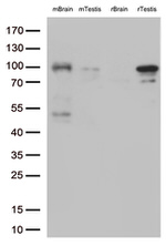 BRAF Antibody in Western Blot (WB)