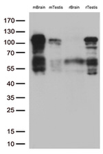 BRAF Antibody in Western Blot (WB)