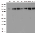 BRAF Antibody in Western Blot (WB)