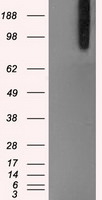 BRAF Antibody in Western Blot (WB)