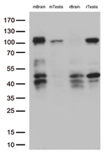 BRAF Antibody in Western Blot (WB)