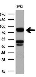 BRAF Antibody in Western Blot (WB)
