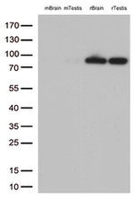 BRAF Antibody in Western Blot (WB)